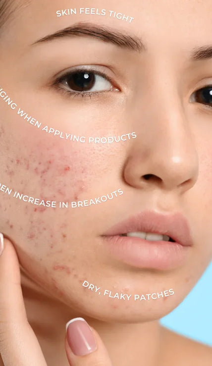 Skin Consultation