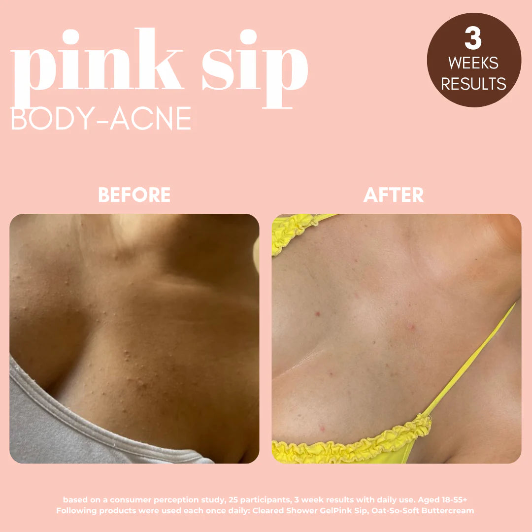 Pink Sip Body Mist with Rose Water & 2% Salicylic Acid 200ml