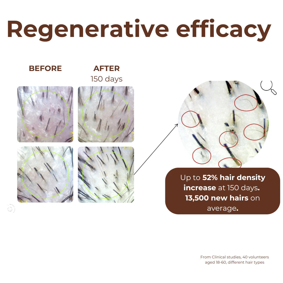 Peptide Miracle Hair Growth Serum with Rosemary Extract & Plant-Stem-Cells 50ml